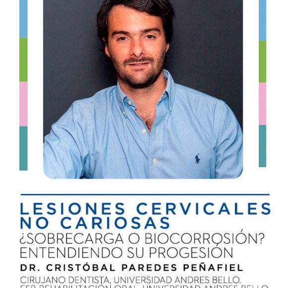 Lesiones cervicales no cariosas: ¿Sobrecarga o Biocorrosión? Lesiones cervicales no cariosas: ¿Sobrecarga o Biocorrosión?