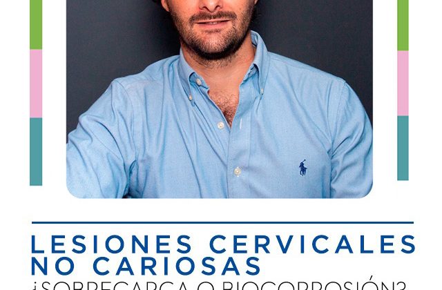 Lesiones cervicales no cariosas: ¿Sobrecarga o Biocorrosión?