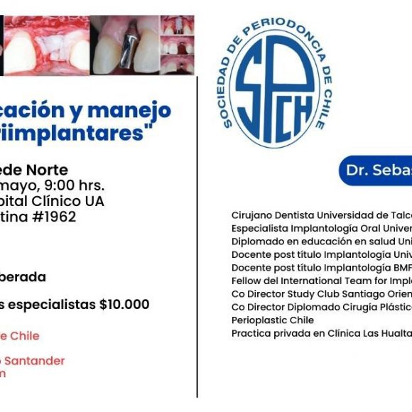 Curso: “Planificación y manejo de tejidos periimplantares”