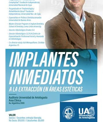 Curso “Implantes Inmediatos a la Extracción en Áreas Estéticas”